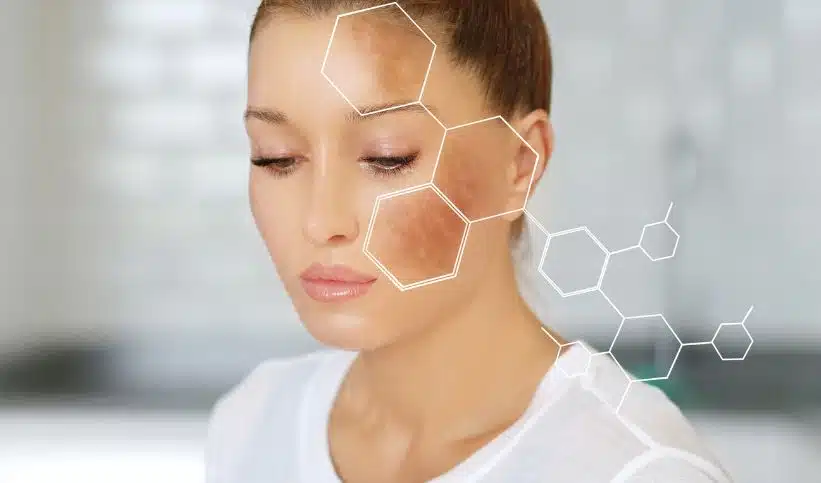 Quels sont les dangers de l’hydroquinone pour la peau ?